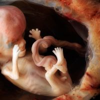 Ethicists Argue There's No Difference Between Aborting Fetuses and Killing Newborns